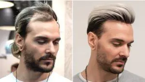 Hair Wigs in Islamabad Rawalpindi For Men Women Hair Unit Wig Maker