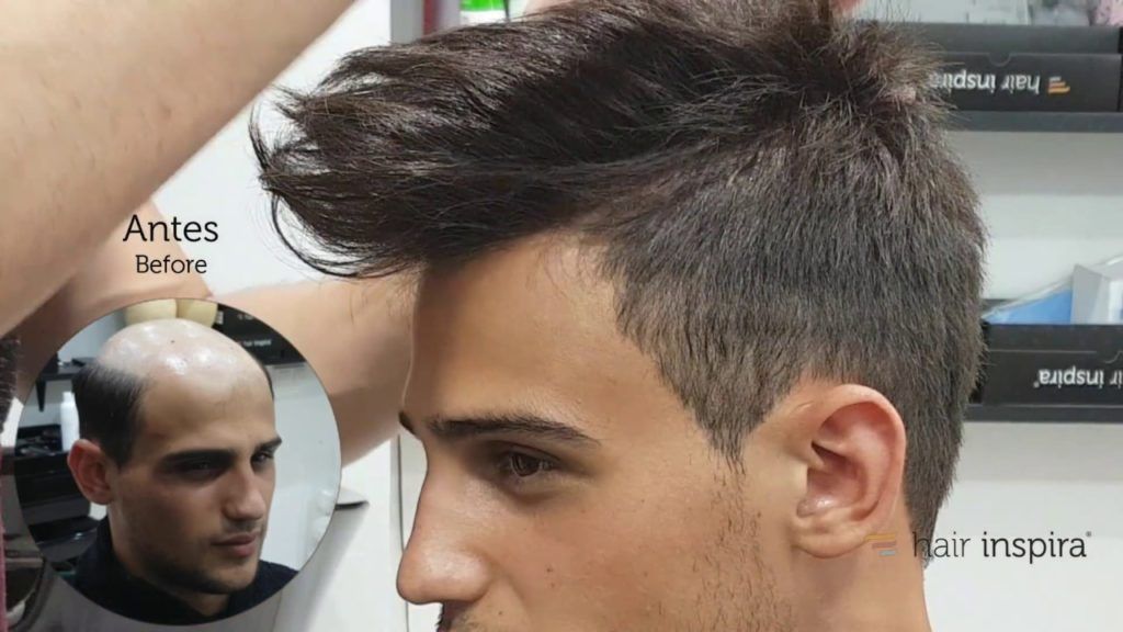 Hair Wigs in Islamabad & Rawalpindi For Men & Women Hair Unit, Wig Maker