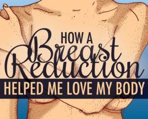 Breast reduction in Islamabad
