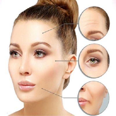 Botox For Wrinkles Treatment in Islamabad