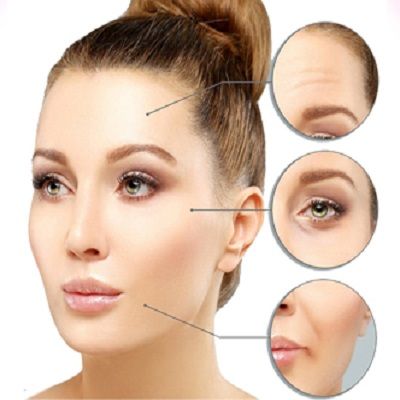 Botox For Wrinkles Treatment in Gujranwala, Peshawar & Islamabad