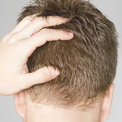 Hair Transplant is Safe and Produces Natural Results