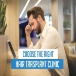 How to Choose the Right Clinic for Hair Transplant