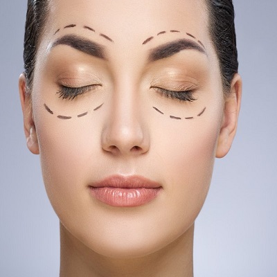 Eyelid Surgery in Islamabad