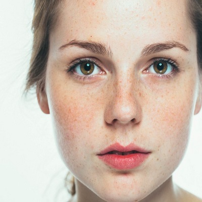 Pigmentation Treatments in Islamabad