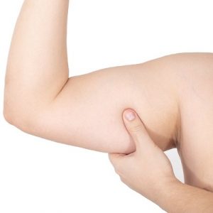 Brachioplasty cost in Islamabad