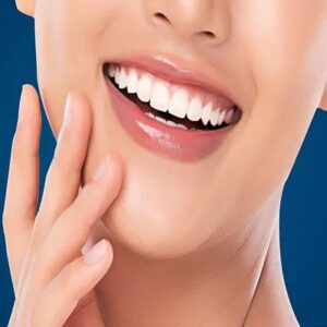 How long does Hollywood smile last?