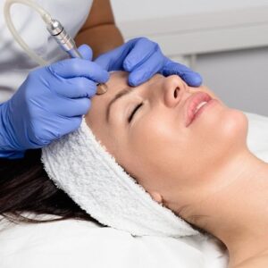 What Are the Benefits of Microdermabrasion?