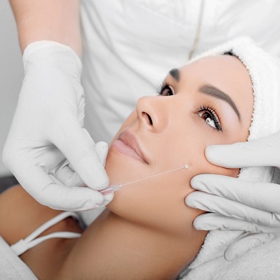 What are the Benefits of Thread Lift?