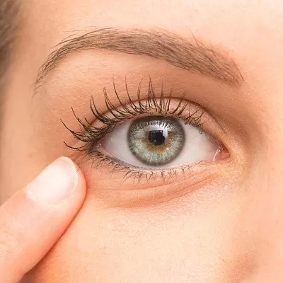 Eye Bag Removal Cost In Islamabad