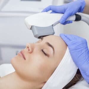 How Successful is Laser Acne Treatment?