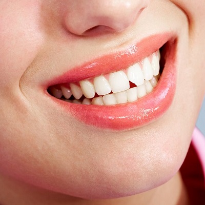 Teeth Fracture Treatment