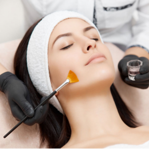 Which 3 Skin Conditions Do Chemical Peels Address?
