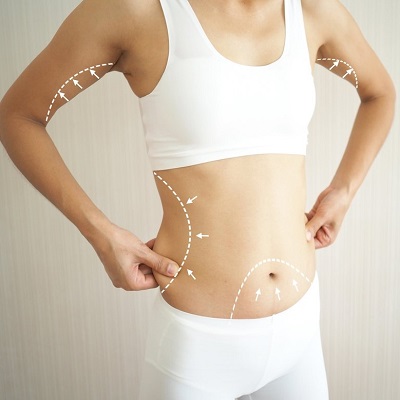 How much weight can I lose from liposuction?
