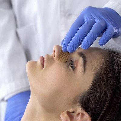 Frequent-Asked Rhinoplasty Questions