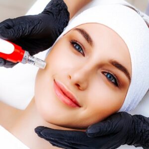 Benefits And Drawbacks of Microneedling