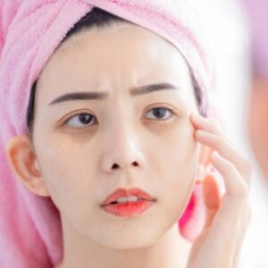 Benefits & Drawbacks of Dark Circles Treatment