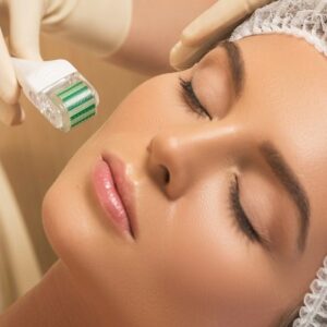 How Microneedling Boost Collagen Production for Youthful Skin?