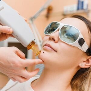 The Mole Dilemma: Choosing the Right Removal Method