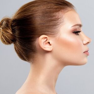 What Are the Benefits and Drawbacks of Nefertiti Treatment?