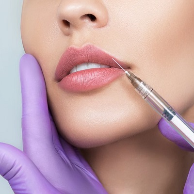 Which One Is Better, Lip Filler or Lip Augmentation?