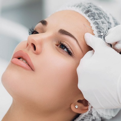 Which Thread Lift Lasts the Longest?