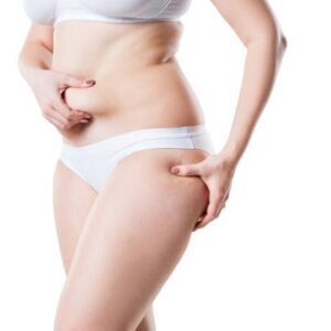 Which Areas You Can Get Rid of Fat Through Liposuction