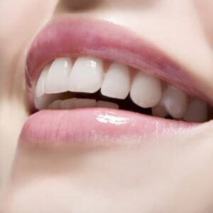 Are Teeth Whitening Strips Better or Laser Treatment?