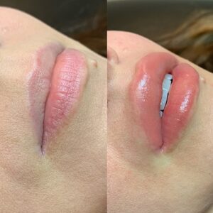 What Does the Lip Blushing Procedure Involve