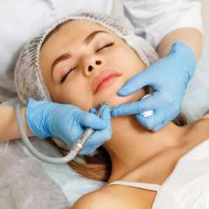 Hydrafacial For Blackheads