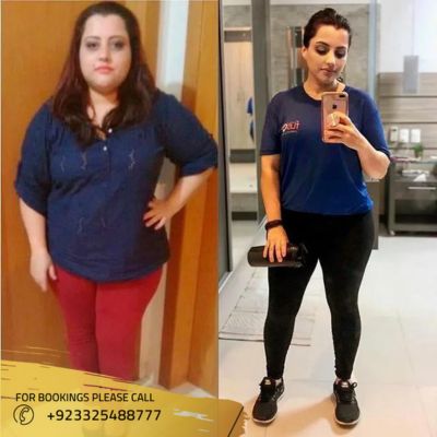 Images of Bariatric surgery in Islamabad