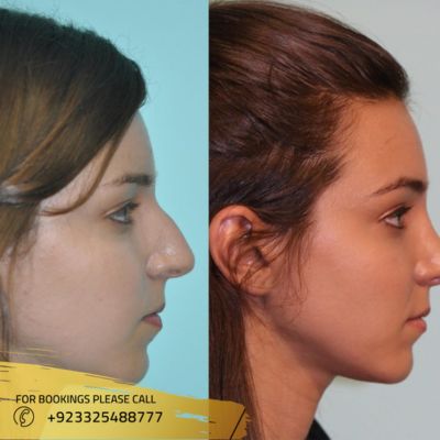 Images of jaw surgery in Islamabad