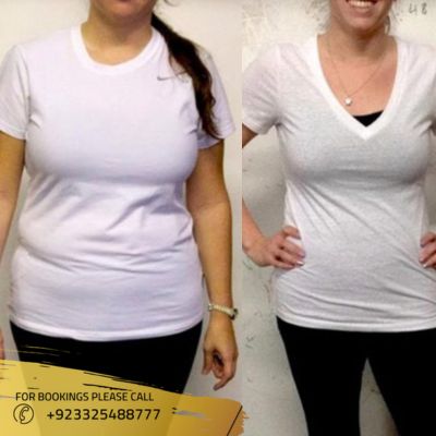 Result of bariatric surgery in Islamabad