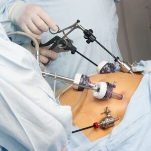 What kinds of conditions can bariatric surgery in Islamabad treat?