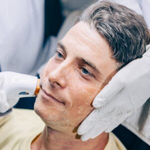 Can Pico laser in Islamabad damage skin?