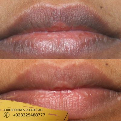 images of smoker lips in Islamabad