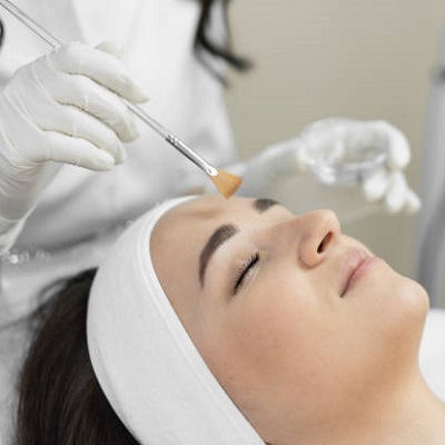 Can I Peel Off the Skin After a Chemical Peel?
