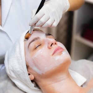 Do dark spots get darker after a chemical peel in Islamabad?