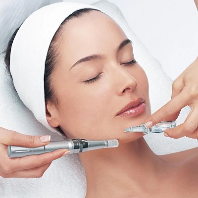 Does Skin Go Back to Normal After Microneedling In Islamabad?