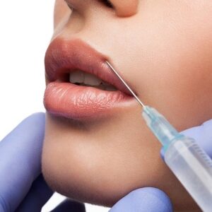 How Long After Lip Fillers Can I Wear Lipstick?