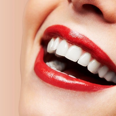 Is Hollywood Smile A Good Idea?
