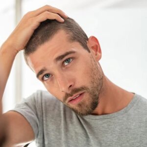 Which vitamin deficiency causes hair loss in Islamabad?