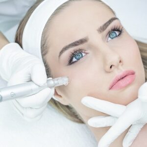 What does microneedling in Islamabad actually do?