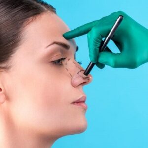 Rhinoplasty surgery cost in Islamabad