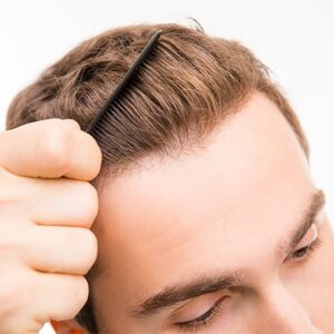 How to Boost Hair Growth After Hair Transplant Surgery?