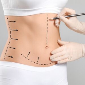 Keeping Your Tummy Tight After Your Tummy Tuck in Islamabad