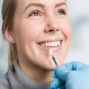 Why Choose Tooth Crew for Your Veneers?