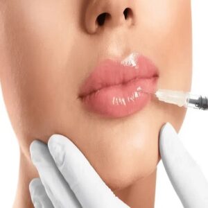 Which Type of Lip Filler is Right for You?