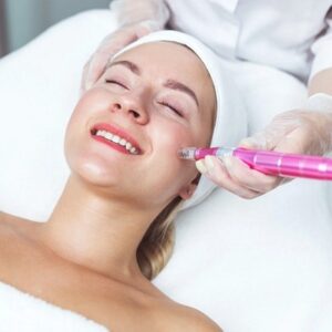 Microneedling for Hyperpigmentation: Can it Help?