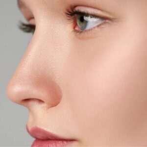 Non-Surgical Rhinoplasty with Thread in Islamabad